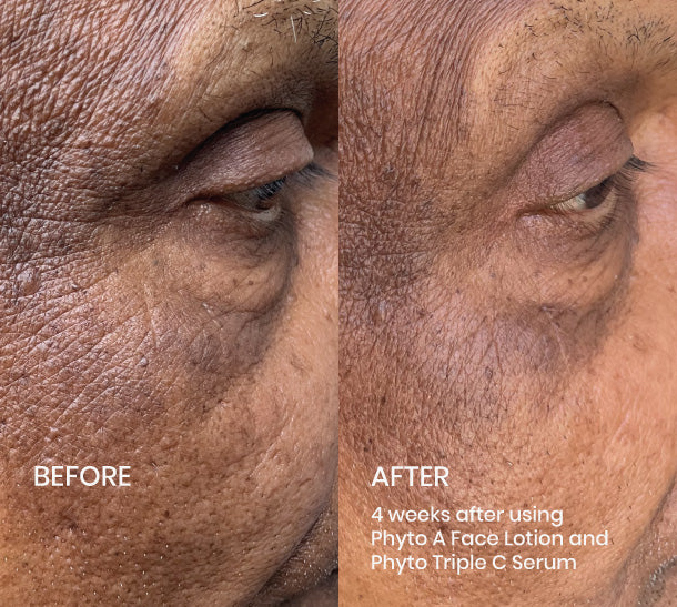Image of Plantkos Phyto A Face Lotion deeply hydrating moisturizer before and after