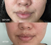 Image of the Plantkos Phyto Repleneshing Facial Essence mist before and after